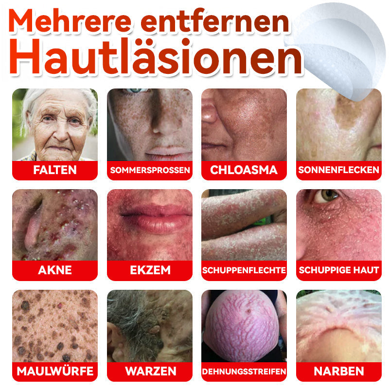 👩‍⚕️ 𝑮𝒍𝒊𝒎𝒎𝒆𝒓𝒍𝒚® 𝑴𝒊𝒌𝒓𝒐𝒏𝒂𝒅𝒆𝒍 𝑩𝒐𝒕𝒂𝒏𝒊𝒔𝒄𝒉 𝑯𝒂𝒖𝒕𝒇𝒍𝒆𝒄𝒌-𝑬𝒏𝒕𝒇𝒆𝒓𝒏𝒖𝒏𝒈𝒔-𝑷𝒇𝒍𝒂𝒔𝒕𝒆𝒓 🇺🇸 Hergestellt in Deutschland