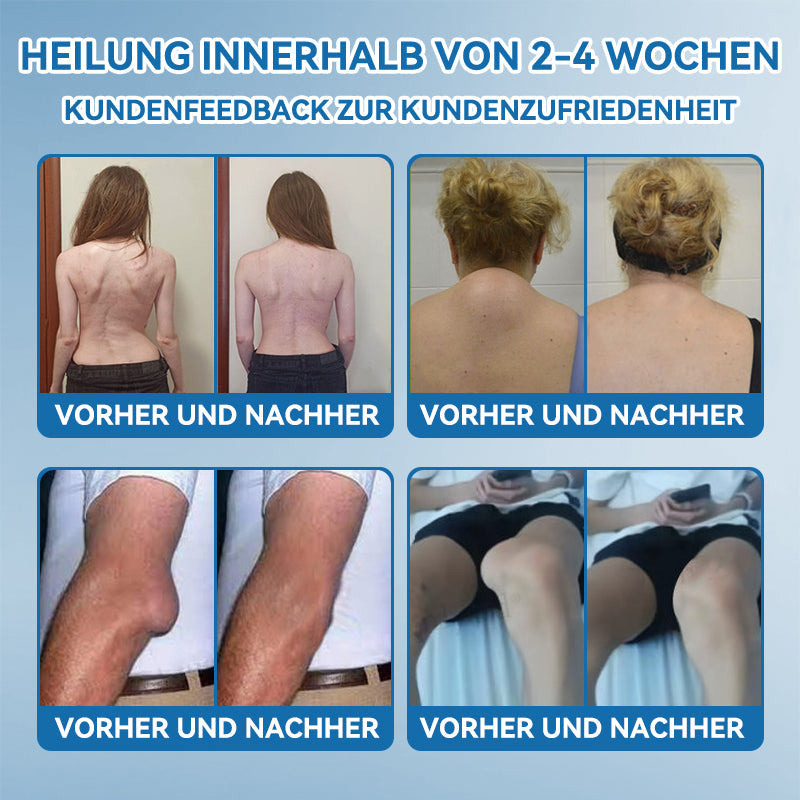 𝐺𝑙𝑖𝑚𝑚𝑒𝑟𝑙𝑦® 𝐵𝑃𝐶-157 𝐺𝑒𝑙𝑒𝑛𝑘ℎ𝑒𝑖𝑙 𝐶𝑟𝑒𝑚𝑒🦴Behandelt Arthritis, Neuropathie, Rheuma, Sportverletzungen und mehr.👍