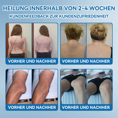 𝐺𝑙𝑖𝑚𝑚𝑒𝑟𝑙𝑦® 𝐵𝑃𝐶-157 𝐺𝑒𝑙𝑒𝑛𝑘ℎ𝑒𝑖𝑙 𝐶𝑟𝑒𝑚𝑒🦴Behandelt Arthritis, Neuropathie, Rheuma, Sportverletzungen und mehr.👍