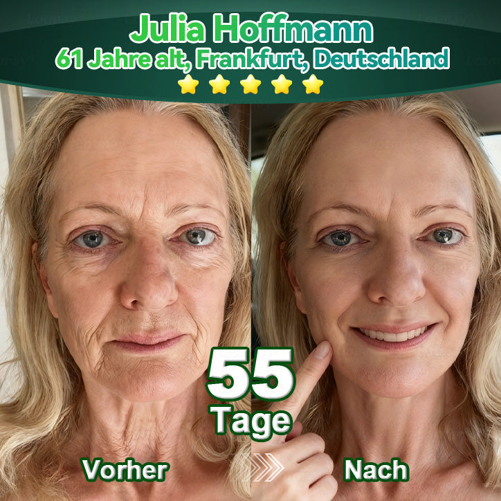 𝐿𝑜𝑡𝑚𝑎𝑦® 𝑆𝑡𝑎𝑚𝑚 𝑍𝑒𝑙𝑙𝑒 & 𝐾𝑜𝑙𝑙𝑎𝑔𝑒𝑛 𝑃𝑒𝑝𝑡𝑖𝑑 𝑜𝑟𝑎𝑙 𝐹𝑙ü𝑠𝑠𝑖𝑔𝑘𝑒𝑖𝑡✨ (𝑆𝑡𝑟𝑎𝑓𝑓𝑢𝑛𝑔 𝑢𝑛𝑑 𝐹𝑒𝑠𝑡𝑖𝑔𝑢𝑛𝑔 𝑠𝑐ℎ𝑙𝑎𝑓𝑓𝑒𝑟 𝐻𝑎𝑢𝑡 𝑢𝑛𝑑 𝑅𝑒𝑑𝑢𝑧𝑖𝑒𝑟𝑢𝑛𝑔 𝑑𝑒𝑟 𝐹𝑎𝑙𝑡𝑒𝑛𝑏𝑖𝑙𝑑𝑢𝑛𝑔)👩‍⚕️