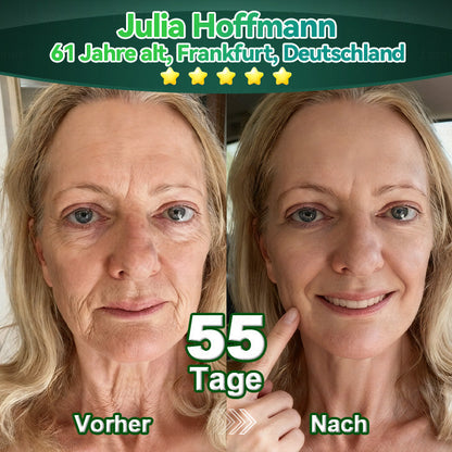 𝐿𝑜𝑡𝑚𝑎𝑦® 𝑆𝑡𝑎𝑚𝑚 𝑍𝑒𝑙𝑙𝑒 & 𝐾𝑜𝑙𝑙𝑎𝑔𝑒𝑛 𝑃𝑒𝑝𝑡𝑖𝑑 𝑜𝑟𝑎𝑙 𝐹𝑙ü𝑠𝑠𝑖𝑔𝑘𝑒𝑖𝑡✨ (𝑆𝑡𝑟𝑎𝑓𝑓𝑢𝑛𝑔 𝑢𝑛𝑑 𝐹𝑒𝑠𝑡𝑖𝑔𝑢𝑛𝑔 𝑠𝑐ℎ𝑙𝑎𝑓𝑓𝑒𝑟 𝐻𝑎𝑢𝑡 𝑢𝑛𝑑 𝑅𝑒𝑑𝑢𝑧𝑖𝑒𝑟𝑢𝑛𝑔 𝑑𝑒𝑟 𝐹𝑎𝑙𝑡𝑒𝑛𝑏𝑖𝑙𝑑𝑢𝑛𝑔)👩‍⚕️