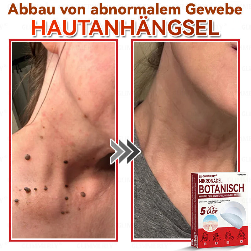 👩‍⚕️ 𝑮𝒍𝒊𝒎𝒎𝒆𝒓𝒍𝒚® 𝑴𝒊𝒌𝒓𝒐𝒏𝒂𝒅𝒆𝒍 𝑩𝒐𝒕𝒂𝒏𝒊𝒔𝒄𝒉 𝑯𝒂𝒖𝒕𝒇𝒍𝒆𝒄𝒌-𝑬𝒏𝒕𝒇𝒆𝒓𝒏𝒖𝒏𝒈𝒔-𝑷𝒇𝒍𝒂𝒔𝒕𝒆𝒓 🇺🇸 Hergestellt in Deutschland