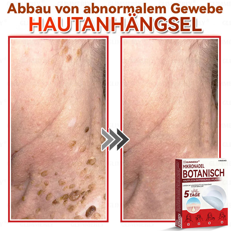 👩‍⚕️ 𝑮𝒍𝒊𝒎𝒎𝒆𝒓𝒍𝒚® 𝑴𝒊𝒌𝒓𝒐𝒏𝒂𝒅𝒆𝒍 𝑩𝒐𝒕𝒂𝒏𝒊𝒔𝒄𝒉 𝑯𝒂𝒖𝒕𝒇𝒍𝒆𝒄𝒌-𝑬𝒏𝒕𝒇𝒆𝒓𝒏𝒖𝒏𝒈𝒔-𝑷𝒇𝒍𝒂𝒔𝒕𝒆𝒓 🇺🇸 Hergestellt in Deutschland