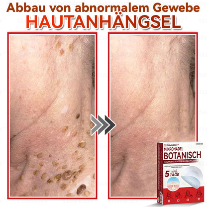 👩‍⚕️ 𝑮𝒍𝒊𝒎𝒎𝒆𝒓𝒍𝒚® 𝑴𝒊𝒌𝒓𝒐𝒏𝒂𝒅𝒆𝒍 𝑩𝒐𝒕𝒂𝒏𝒊𝒔𝒄𝒉 𝑯𝒂𝒖𝒕𝒇𝒍𝒆𝒄𝒌-𝑬𝒏𝒕𝒇𝒆𝒓𝒏𝒖𝒏𝒈𝒔-𝑷𝒇𝒍𝒂𝒔𝒕𝒆𝒓 🇺🇸 Hergestellt in Deutschland