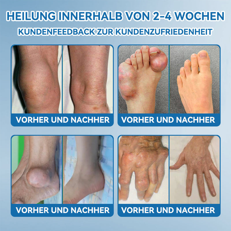 𝐺𝑙𝑖𝑚𝑚𝑒𝑟𝑙𝑦® 𝐵𝑃𝐶-157 𝐺𝑒𝑙𝑒𝑛𝑘ℎ𝑒𝑖𝑙 𝐶𝑟𝑒𝑚𝑒🦴Behandelt Arthritis, Neuropathie, Rheuma, Sportverletzungen und mehr.👍