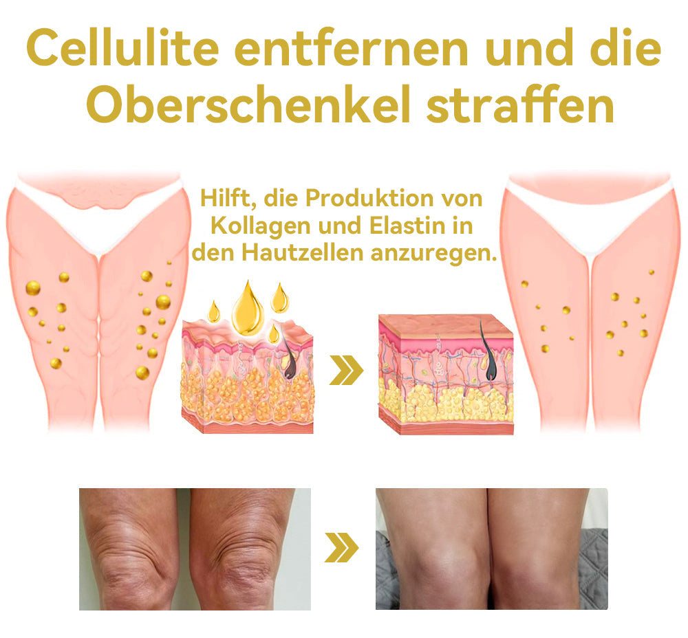 🌸𝐆𝐥𝐢𝐦𝐦𝐞𝐫𝐥𝐲® 𝐀𝐧𝐭𝐢-𝐅𝐚𝐥𝐭𝐞𝐧-𝐒𝐭𝐫𝐚𝐟𝐟𝐞𝐧𝐝𝐞 𝐌𝐞𝐡𝐫𝐳𝐰𝐞𝐜𝐤𝐜𝐫𝐞𝐦𝐞 Pro