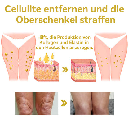 🌸𝐆𝐥𝐢𝐦𝐦𝐞𝐫𝐥𝐲® 𝐀𝐧𝐭𝐢-𝐅𝐚𝐥𝐭𝐞𝐧-𝐒𝐭𝐫𝐚𝐟𝐟𝐞𝐧𝐝𝐞 𝐌𝐞𝐡𝐫𝐳𝐰𝐞𝐜𝐤𝐜𝐫𝐞𝐦𝐞 Pro