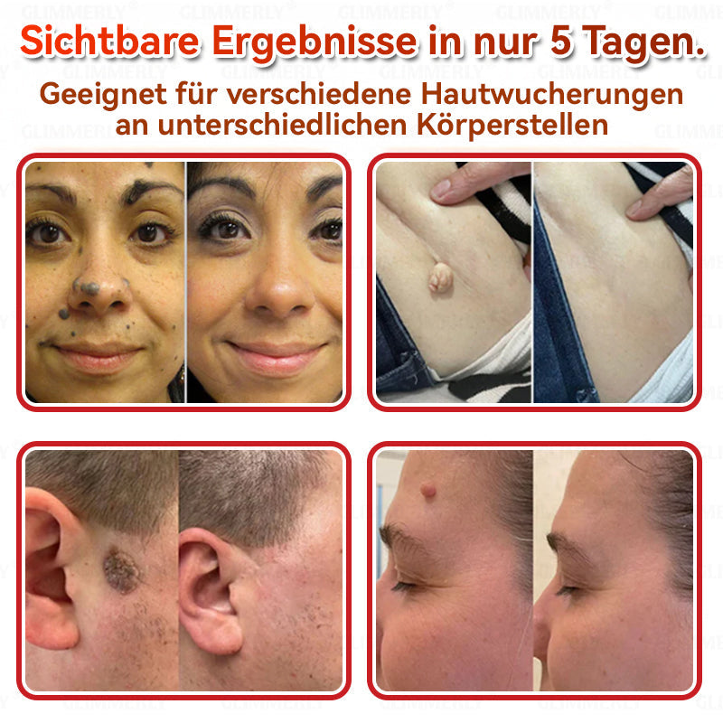 👩‍⚕️ 𝑮𝒍𝒊𝒎𝒎𝒆𝒓𝒍𝒚® 𝑴𝒊𝒌𝒓𝒐𝒏𝒂𝒅𝒆𝒍 𝑩𝒐𝒕𝒂𝒏𝒊𝒔𝒄𝒉 𝑯𝒂𝒖𝒕𝒇𝒍𝒆𝒄𝒌-𝑬𝒏𝒕𝒇𝒆𝒓𝒏𝒖𝒏𝒈𝒔-𝑷𝒇𝒍𝒂𝒔𝒕𝒆𝒓 🇺🇸 Hergestellt in Deutschland