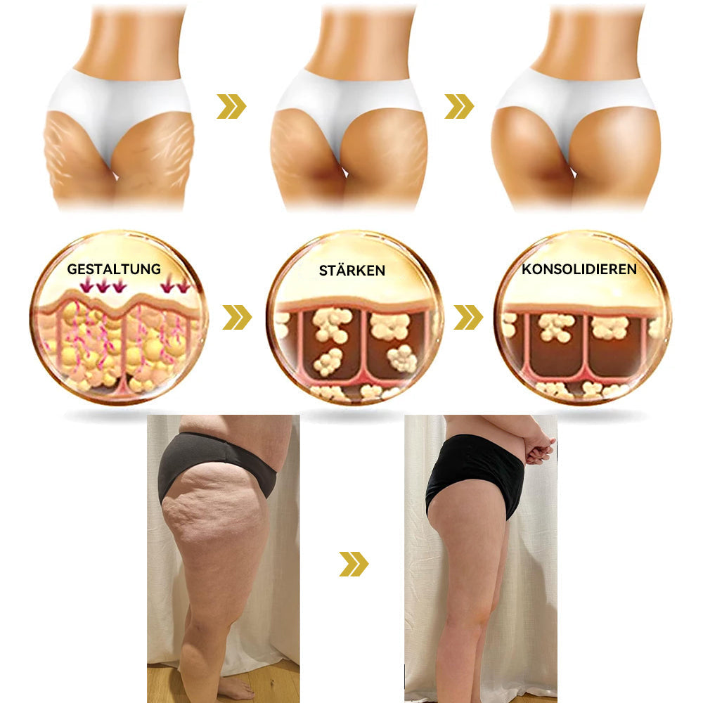 🌸𝐆𝐥𝐢𝐦𝐦𝐞𝐫𝐥𝐲® 𝐀𝐧𝐭𝐢-𝐅𝐚𝐥𝐭𝐞𝐧-𝐒𝐭𝐫𝐚𝐟𝐟𝐞𝐧𝐝𝐞 𝐌𝐞𝐡𝐫𝐳𝐰𝐞𝐜𝐤𝐜𝐫𝐞𝐦𝐞 Pro