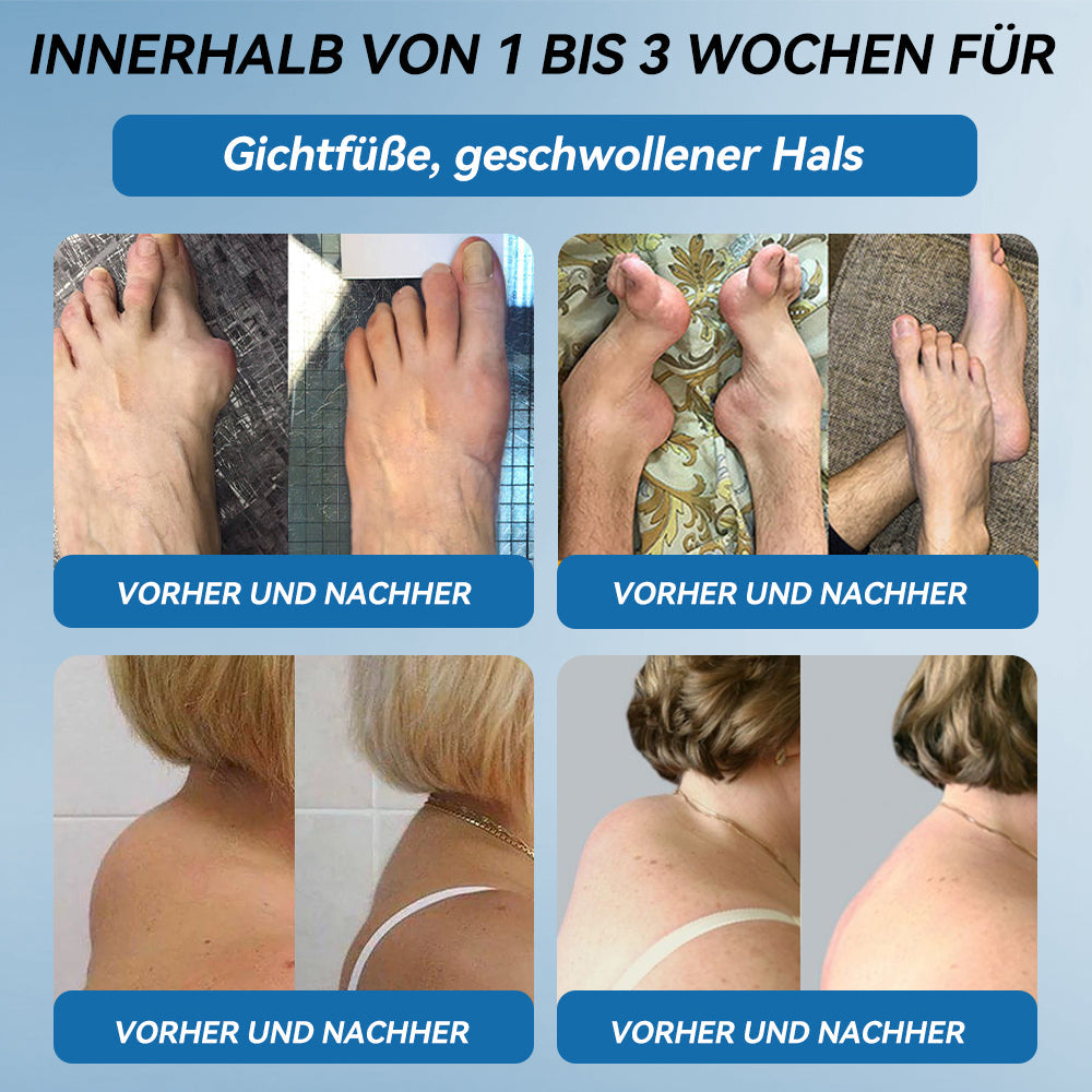 𝐺𝑙𝑖𝑚𝑚𝑒𝑟𝑙𝑦® 𝐵𝑃𝐶-157 𝐺𝑒𝑙𝑒𝑛𝑘ℎ𝑒𝑖𝑙 𝐶𝑟𝑒𝑚𝑒🦴Behandelt Arthritis, Neuropathie, Rheuma, Sportverletzungen und mehr.👍