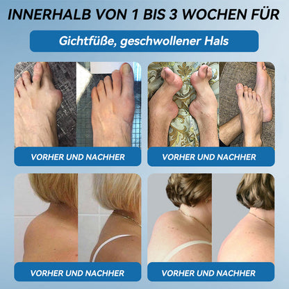 𝐺𝑙𝑖𝑚𝑚𝑒𝑟𝑙𝑦® 𝐵𝑃𝐶-157 𝐺𝑒𝑙𝑒𝑛𝑘ℎ𝑒𝑖𝑙 𝐶𝑟𝑒𝑚𝑒🦴Behandelt Arthritis, Neuropathie, Rheuma, Sportverletzungen und mehr.👍