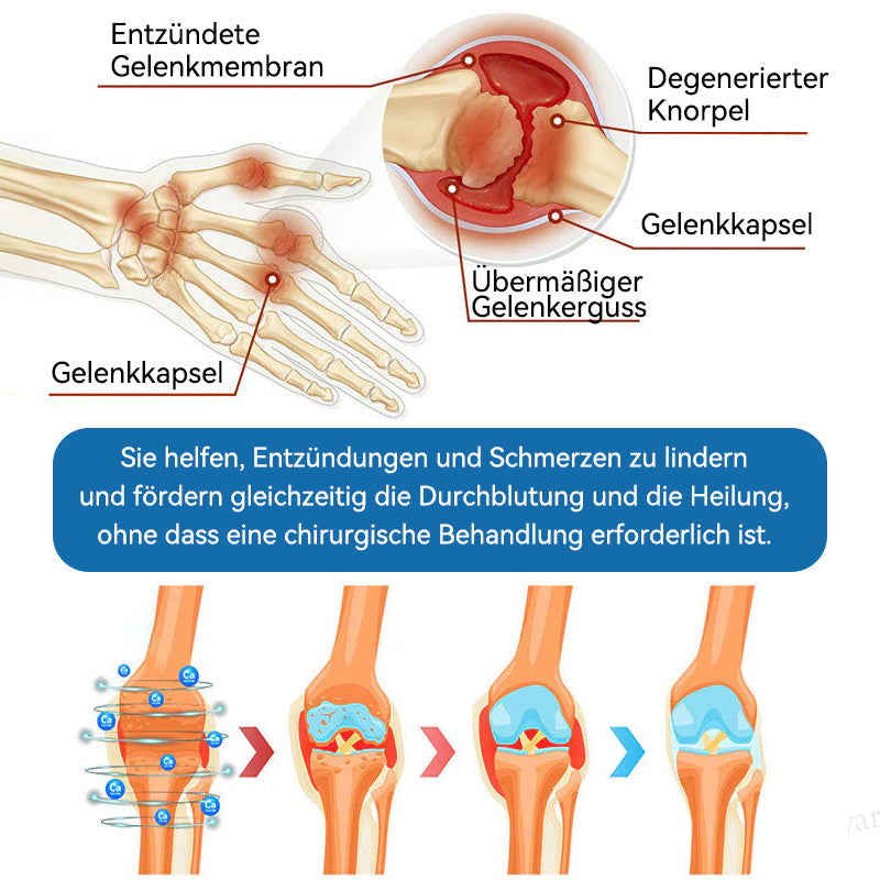 𝐺𝑙𝑖𝑚𝑚𝑒𝑟𝑙𝑦® 𝐵𝑃𝐶-157 𝐺𝑒𝑙𝑒𝑛𝑘ℎ𝑒𝑖𝑙 𝐶𝑟𝑒𝑚𝑒🦴Behandelt Arthritis, Neuropathie, Rheuma, Sportverletzungen und mehr.👍