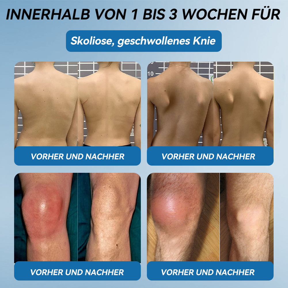 𝐺𝑙𝑖𝑚𝑚𝑒𝑟𝑙𝑦® 𝐵𝑃𝐶-157 𝐺𝑒𝑙𝑒𝑛𝑘ℎ𝑒𝑖𝑙 𝐶𝑟𝑒𝑚𝑒🦴Behandelt Arthritis, Neuropathie, Rheuma, Sportverletzungen und mehr.👍