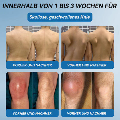 𝐺𝑙𝑖𝑚𝑚𝑒𝑟𝑙𝑦® 𝐵𝑃𝐶-157 𝐺𝑒𝑙𝑒𝑛𝑘ℎ𝑒𝑖𝑙 𝐶𝑟𝑒𝑚𝑒🦴Behandelt Arthritis, Neuropathie, Rheuma, Sportverletzungen und mehr.👍