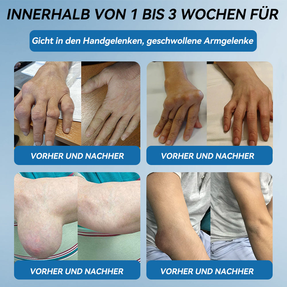 𝐺𝑙𝑖𝑚𝑚𝑒𝑟𝑙𝑦® 𝐵𝑃𝐶-157 𝐺𝑒𝑙𝑒𝑛𝑘ℎ𝑒𝑖𝑙 𝐶𝑟𝑒𝑚𝑒🦴Behandelt Arthritis, Neuropathie, Rheuma, Sportverletzungen und mehr.👍