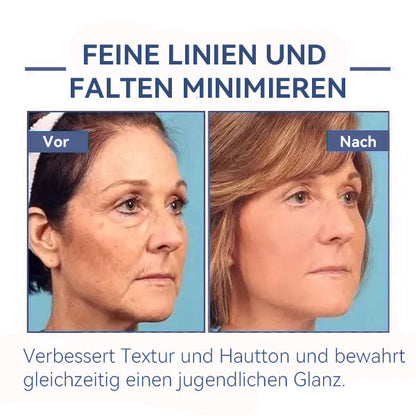 🌸𝐆𝐥𝐢𝐦𝐦𝐞𝐫𝐥𝐲® 𝐀𝐧𝐭𝐢-𝐅𝐚𝐥𝐭𝐞𝐧-𝐒𝐭𝐫𝐚𝐟𝐟𝐞𝐧𝐝𝐞 𝐌𝐞𝐡𝐫𝐳𝐰𝐞𝐜𝐤𝐜𝐫𝐞𝐦𝐞 Pro