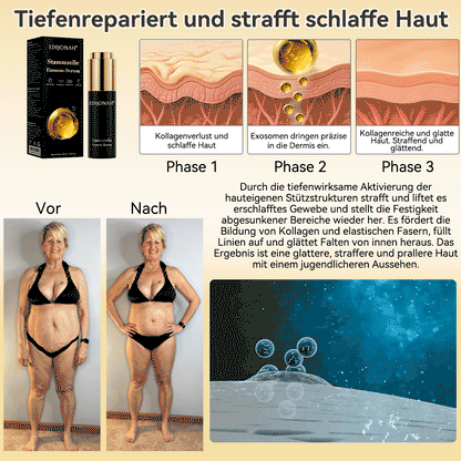 🌿𝑬𝐷𝐼𝐽𝑂𝑁𝐴𝐻® 𝑆𝑡𝑎𝑚𝑚𝑧𝑒𝑙𝑙𝑒 𝐸𝑥𝑜𝑠𝑜𝑚-𝑆𝑒𝑟𝑢𝑚 - 🎎👩‍⚕️（ Wirkt Anti-Aging, reduziert Falten, verbessert die Festigkeit, steigert die Ausstrahlung, spendet intensive Feuchtigkeit.）