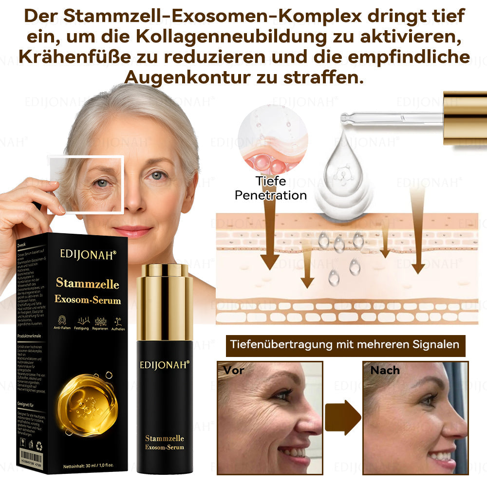 🌿𝑬𝐷𝐼𝐽𝑂𝑁𝐴𝐻® 𝑆𝑡𝑎𝑚𝑚𝑧𝑒𝑙𝑙𝑒 𝐸𝑥𝑜𝑠𝑜𝑚-𝑆𝑒𝑟𝑢𝑚 - 🎎👩‍⚕️（ Wirkt Anti-Aging, reduziert Falten, verbessert die Festigkeit, steigert die Ausstrahlung, spendet intensive Feuchtigkeit.）