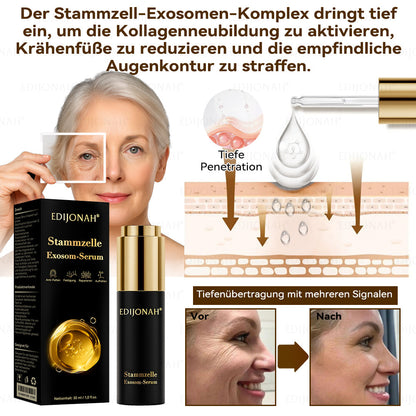 🌿𝑬𝐷𝐼𝐽𝑂𝑁𝐴𝐻® 𝑆𝑡𝑎𝑚𝑚𝑧𝑒𝑙𝑙𝑒 𝐸𝑥𝑜𝑠𝑜𝑚-𝑆𝑒𝑟𝑢𝑚 - 🎎👩‍⚕️（ Wirkt Anti-Aging, reduziert Falten, verbessert die Festigkeit, steigert die Ausstrahlung, spendet intensive Feuchtigkeit.）