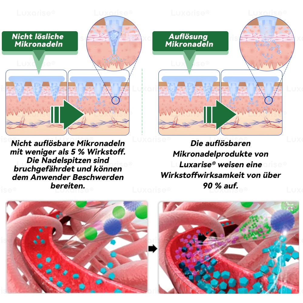 𝑶𝒇𝒇𝒊𝒄𝒊𝒂𝒍 𝑺𝒕𝒐𝒓𝒆  |🏷️𝙇𝙪𝙭𝒂𝒓𝒊𝒔𝒆® 𝑴𝒐𝒓𝒊𝒏𝒈𝒂 𝒙 𝑩𝒆𝒓𝒃𝒆𝒓𝒊𝒏 10-𝑰𝑵-1 𝒇𝒐𝒓𝒕𝒈𝒆𝒔𝒄𝒉𝒓𝒊𝒕𝒕𝒆𝒏 𝑵𝒂𝒏𝒐 𝑴𝒊𝒌𝒓𝒐𝒏𝒂𝒅𝒆𝒍 𝑷𝒇𝒍𝒂𝒔𝒕𝒆𝒓 (𝑬𝒊𝒏𝒎𝒂𝒍 𝒕ä𝒈𝒍𝒊𝒄𝒉, 𝒔𝒊𝒄𝒉𝒕𝒃𝒂𝒓𝒆 𝑽𝒆𝒓ä𝒏𝒅𝒆𝒓𝒖𝒏𝒈𝒆𝒏 𝒊𝒏 7 𝑻𝒂𝒈𝒆𝒏）✅ 𝑨𝒅𝒊𝒑𝒐𝒔𝒊𝒕𝒂𝒔, 𝑫𝒊𝒂𝒃𝒆𝒕𝒆𝒔, 𝑺𝒄𝒉𝒍𝒂𝒇𝒂𝒑𝒏𝒐𝒆 𝒖𝒏𝒅 𝑮𝒆𝒍𝒆𝒏𝒌𝒑𝒓𝒐𝒃𝒍𝒆𝒎𝒆