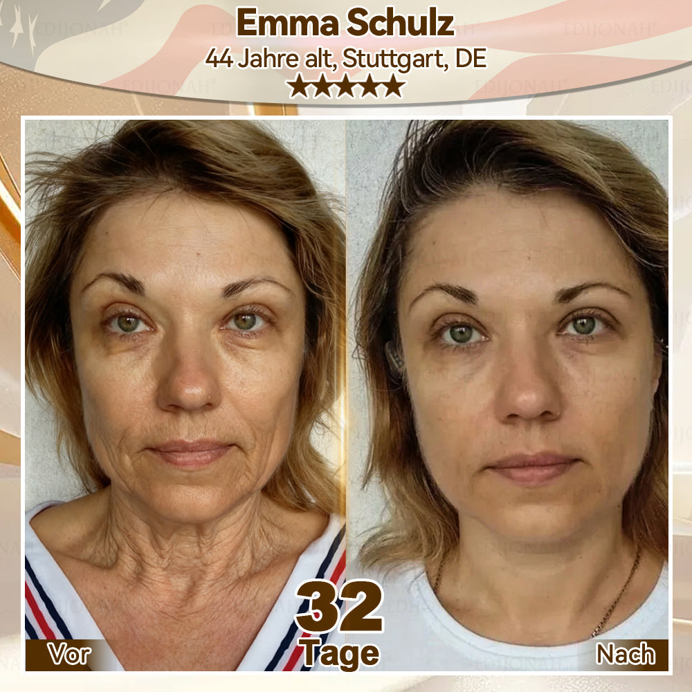 🌿𝑬𝐷𝐼𝐽𝑂𝑁𝐴𝐻® 𝑆𝑡𝑎𝑚𝑚𝑧𝑒𝑙𝑙𝑒 𝐸𝑥𝑜𝑠𝑜𝑚-𝑆𝑒𝑟𝑢𝑚 - 🎎👩‍⚕️（ Wirkt Anti-Aging, reduziert Falten, verbessert die Festigkeit, steigert die Ausstrahlung, spendet intensive Feuchtigkeit.）