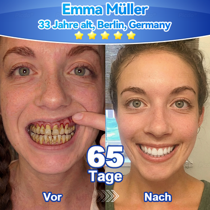 🏥𝑃𝑖𝑐𝑑𝑜® 𝑆𝑡𝑎𝑚𝑚𝑧𝑒𝑙𝑙𝑒𝑛 𝑍𝑎ℎ𝑛𝑓𝑙𝑒𝑖𝑠𝑐ℎ 𝑅𝑒𝑝𝑎𝑟𝑎𝑡𝑢𝑟 𝑀𝑜𝑢𝑠𝑠 🎫👩‍⚕️(🦷𝘍ö𝘳𝘥𝘦𝘳𝘵 𝘥𝘢𝘴 𝘡𝘢𝘩𝘯𝘸𝘢𝘤𝘩𝘴𝘵𝘶𝘮 • 𝘌𝘯𝘵𝘧𝘦𝘳𝘯𝘵 𝘡𝘢𝘩𝘯𝘴𝘵𝘦𝘪𝘯 • 𝘚𝘵ä𝘳𝘬𝘵 𝘥𝘢𝘴 𝘡𝘢𝘩𝘯𝘧𝘭𝘦𝘪𝘴𝘤𝘩 • 𝘙𝘦𝘪𝘯𝘪𝘨𝘵 𝘨𝘳ü𝘯𝘥𝘭𝘪𝘤𝘩 𝘶𝘯𝘥 𝘴𝘰𝘳𝘨𝘵 𝘧ü𝘳 𝘧𝘳𝘪𝘴𝘤𝘩𝘦𝘯 𝘈𝘵𝘦𝘮) 👩‍⚕️