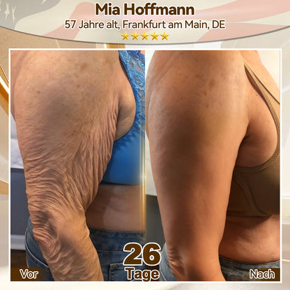 🌿𝑬𝐷𝐼𝐽𝑂𝑁𝐴𝐻® 𝑆𝑡𝑎𝑚𝑚𝑧𝑒𝑙𝑙𝑒 𝐸𝑥𝑜𝑠𝑜𝑚-𝑆𝑒𝑟𝑢𝑚 - 🎎👩‍⚕️（ Wirkt Anti-Aging, reduziert Falten, verbessert die Festigkeit, steigert die Ausstrahlung, spendet intensive Feuchtigkeit.）