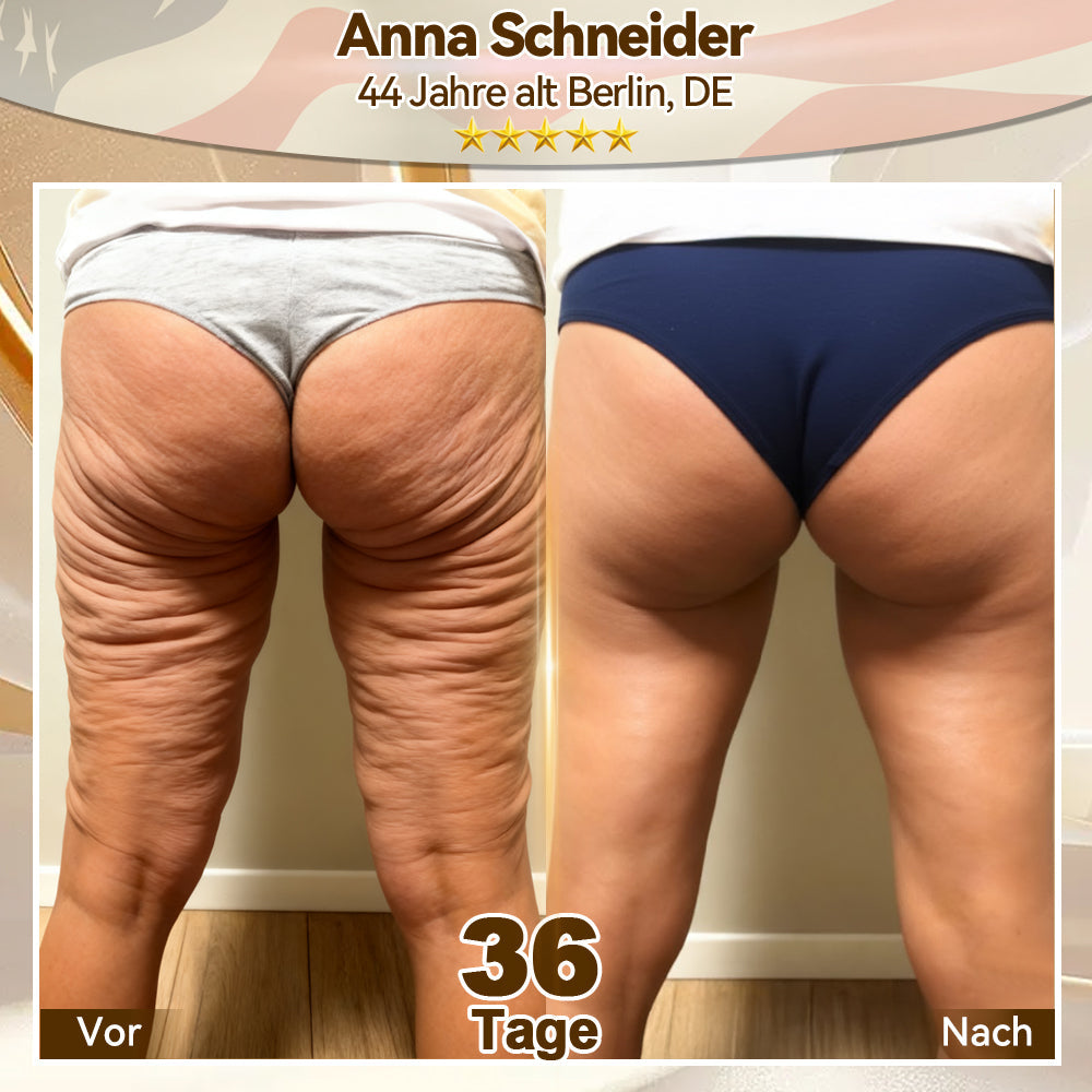🌿𝑬𝐷𝐼𝐽𝑂𝑁𝐴𝐻® 𝑆𝑡𝑎𝑚𝑚𝑧𝑒𝑙𝑙𝑒 𝐸𝑥𝑜𝑠𝑜𝑚-𝑆𝑒𝑟𝑢𝑚 - 🎎👩‍⚕️（ Wirkt Anti-Aging, reduziert Falten, verbessert die Festigkeit, steigert die Ausstrahlung, spendet intensive Feuchtigkeit.）