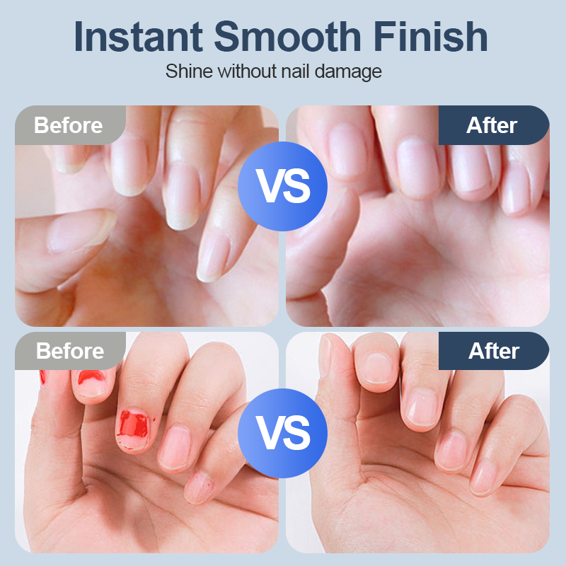 🎈🎈Universeller automatischer Nageltrimmer – 6 Geschwindigkeitsstufen, ausgestattet mit 5 Aufsätzen, sicher und sanft für die Nagelpflege 💅✨